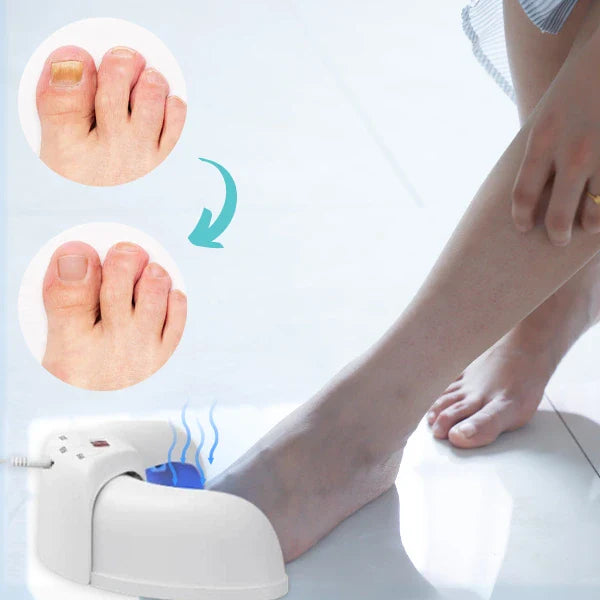 Laserterapienhet for neglesoppbehandling